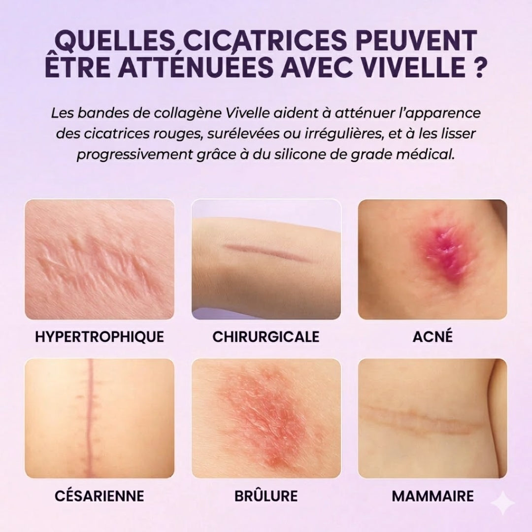 Vivelle™ - Bandes de Collagènes pour Cicatrices & Rides