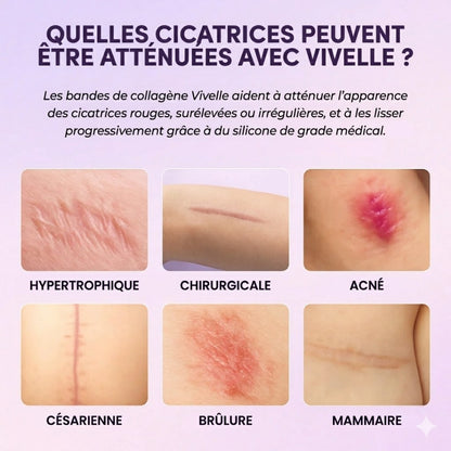 Vivelle™ - Bandes de Collagènes pour Cicatrices & Rides